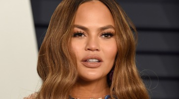 Chrissy Teigen terhesen botoxolt a fejfájása ellen