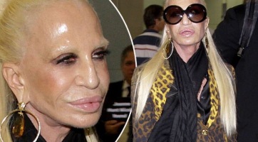 Donatella Versace arca nagyon furcsa lett