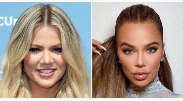 Khloé Kardashian csak egy orrműtétet vallott be