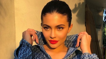Kylie Jenner szája újra a régi