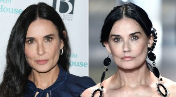 Mindenki Demi Moore beesett arcáról beszél most
