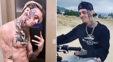 Óriási arctetkóval csúfította el magát Aaron Carter