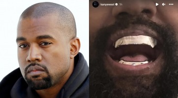 Közel 300 millió forintos új titán fogsort kapott Kanye West