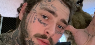 Post Malone egyszerre ment fogorvoshoz és tetováltatni