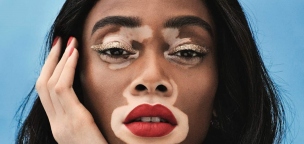 Winnie Harlow nehezményezte, hogy fapados járattal kellett utaznia